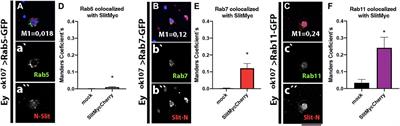 Autocrine/Paracrine Slit–Robo Signaling Controls Optic Lobe Development in Drosophila melanogaster